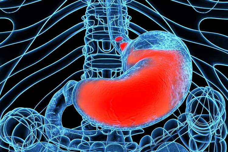 Frequent Acid Reflux - Reduce Symptoms With Better Timing